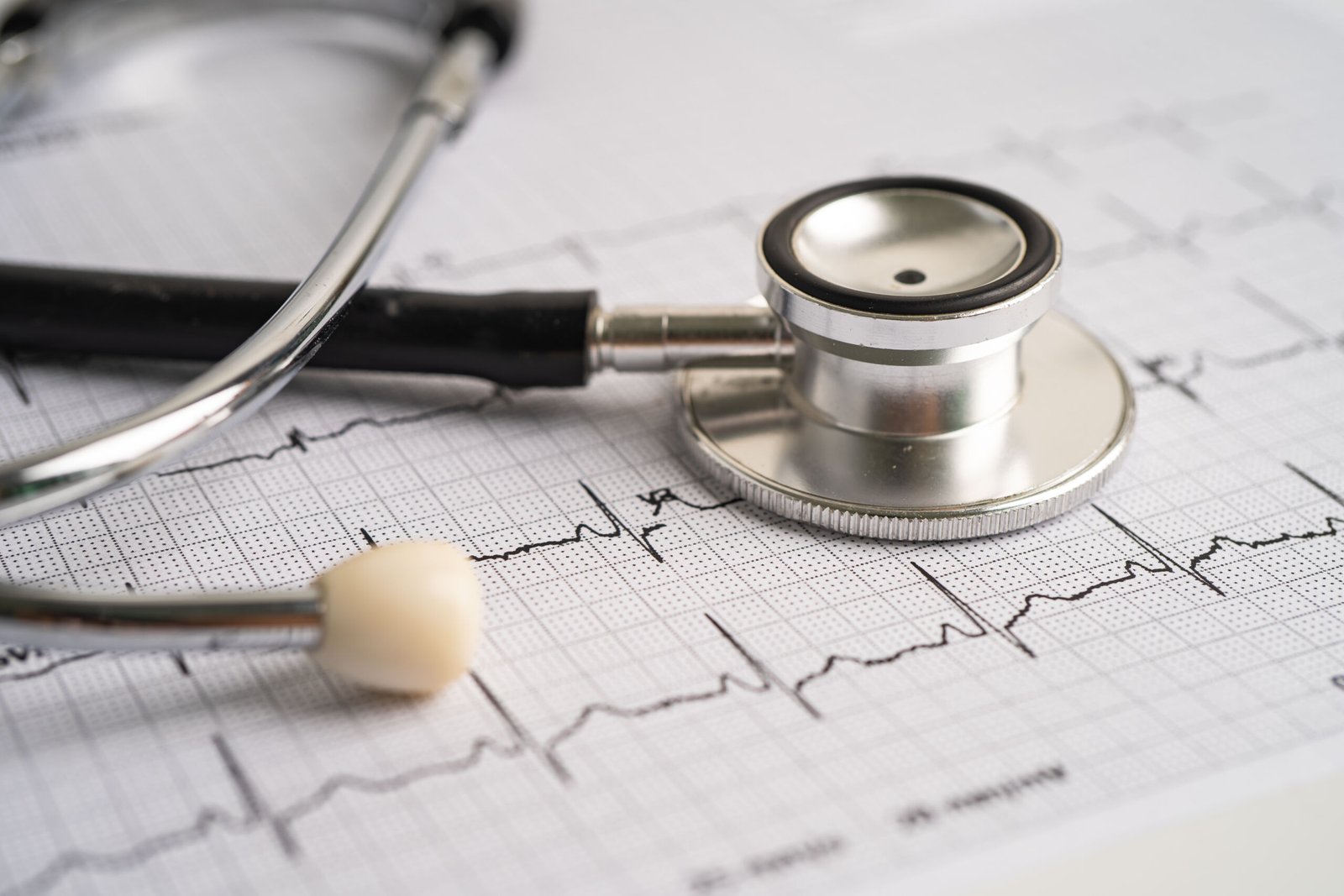 Stethoscope on ECG printout showing heart rhythm, illustrating chest pain causes related to heart conditions and heart attacks